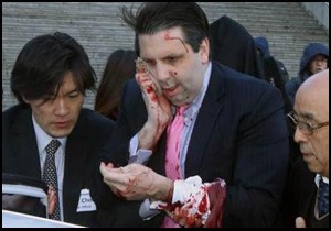 ABD nin Seul Büyükelçisi Mark Lippert a usturalı saldırı