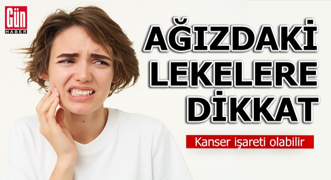  Ağızdaki kırmızı ve beyaz lekeler kanser işareti olabilir 