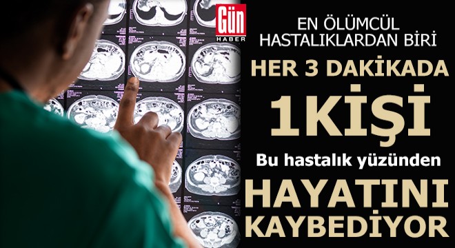  Her 3 dakikada bir kişi hayatını kaybediyor 