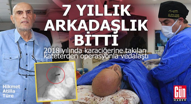 7 yıllık karaciğer arkadaşlığı bir operasyonla bitti