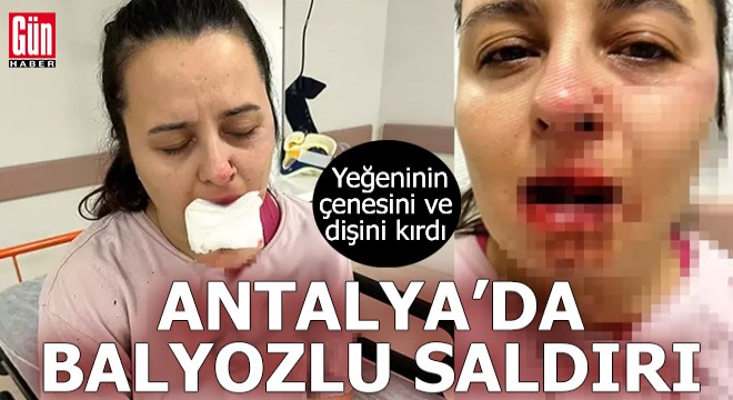 Antalya da balyozlu saldırı!