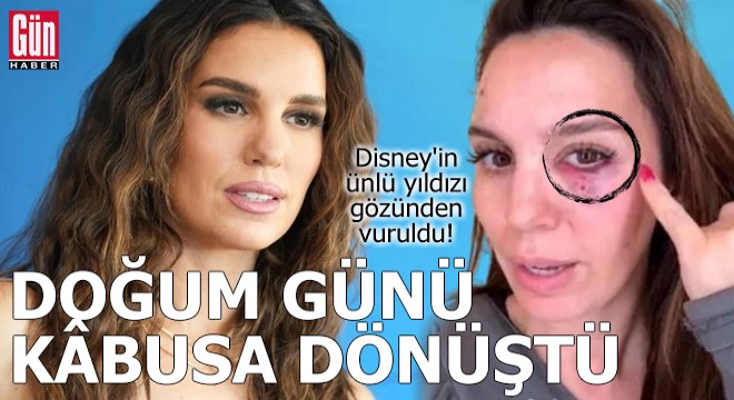 Doğum günü kâbusa dönüştü: Disney yıldızı gözünden vuruldu