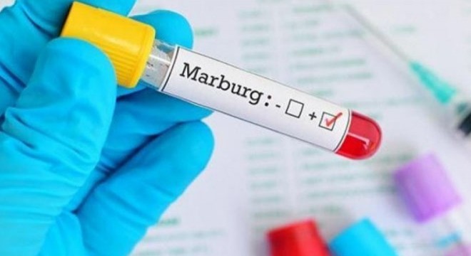 Tanzanya da Marburg virüsü nedeniyle 8 kişi hayatını kaybetti