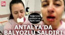 Antalya'da balyozlu saldırı!