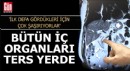 Bütün iç organları ters yerde